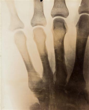 (X-RAYS) A small archive of 14 X-rays and related imagery documenting early use of the technology at Wesleyan University.